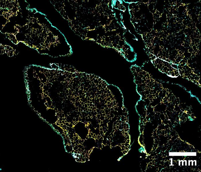 Confocal microscopy fluorescent images of a human omental adipose tissue section (visceral fat), depicting the mesothelial cell layer surrounding lobules of adipocytes.