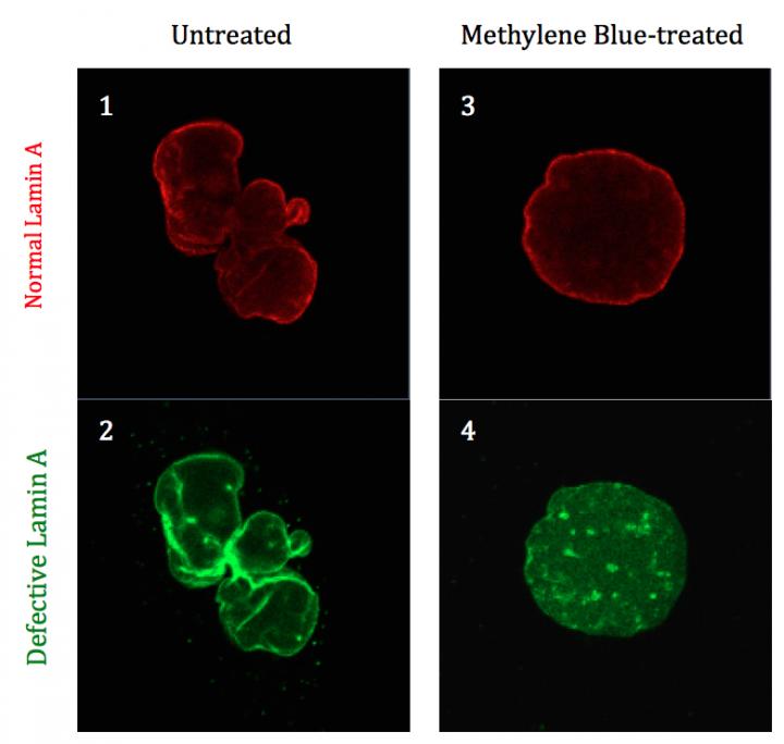 Methylene Blue Repairs Progeria-Related Damage to Cell Nuclei