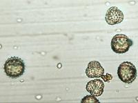 Ragweed Pollen Grains