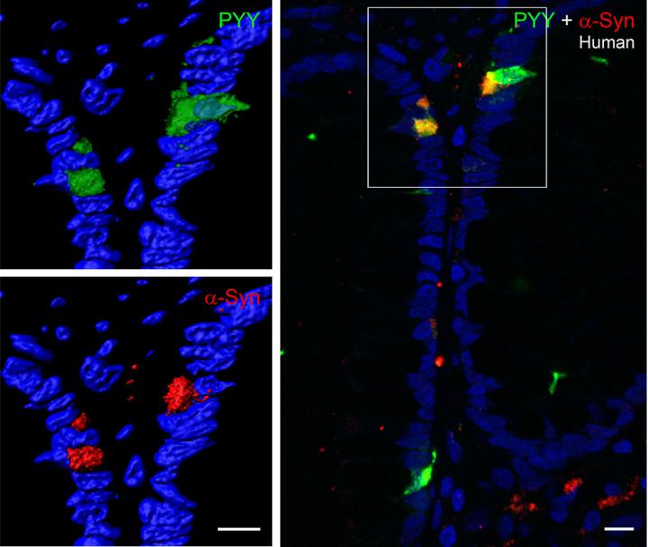 Parkinson's-linked Protein in Human Colon