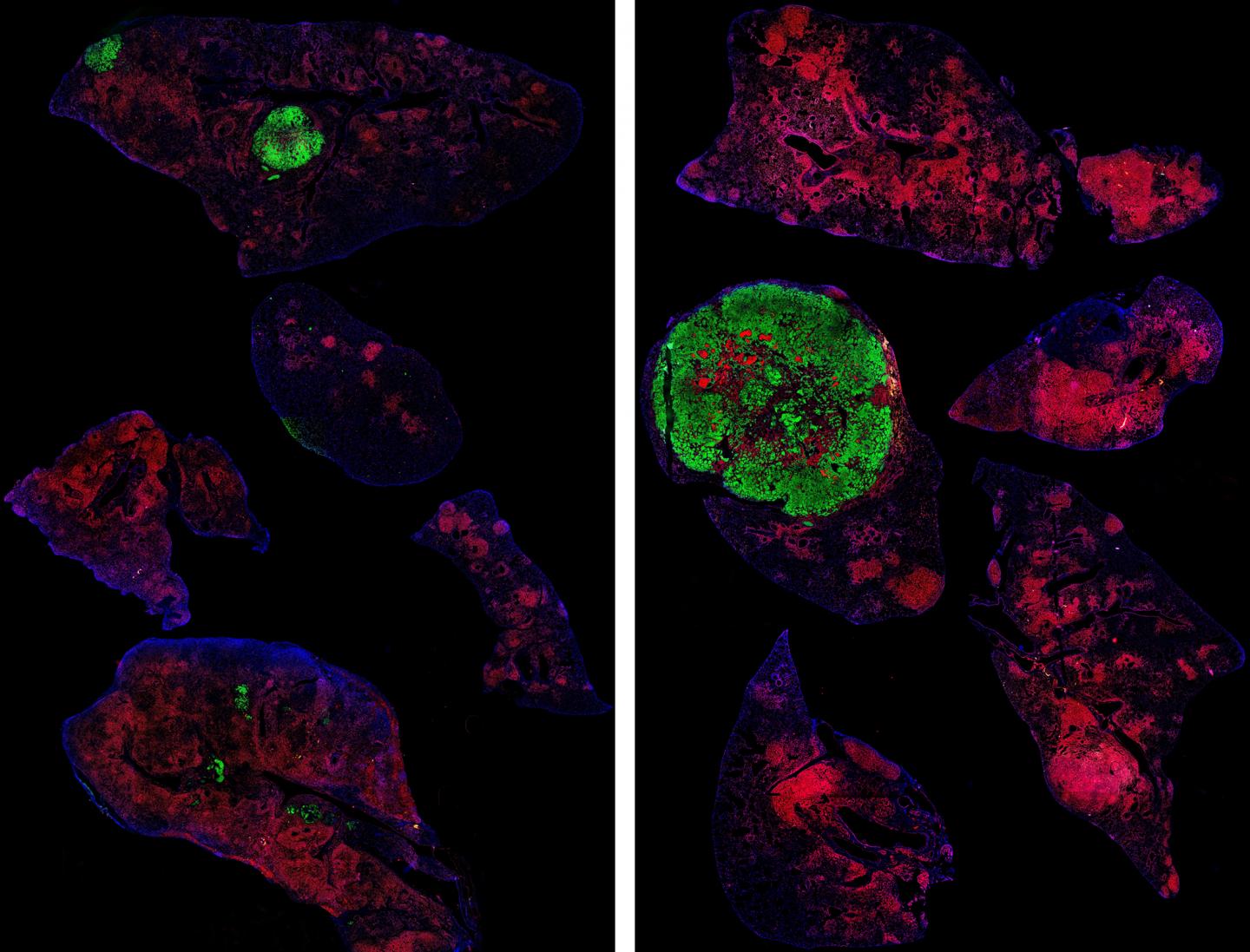 Preclinical Research Suggests Anti-Cancer Effect of Keto Diet