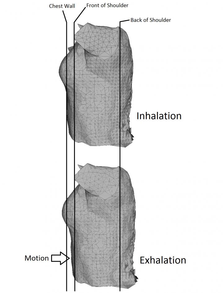 Motion Comparison (1 of 2)