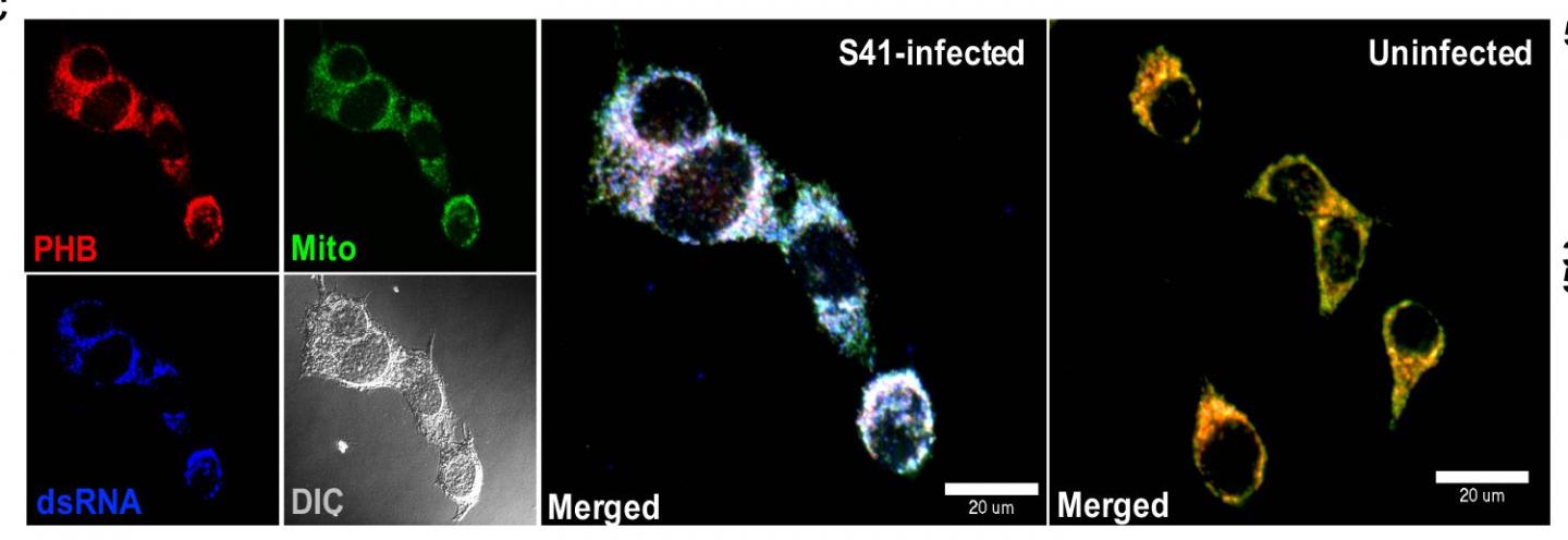 Human Protein May Aid Neuron Invasion by Virus that Causes Hand, Foot, and Mouth Disease