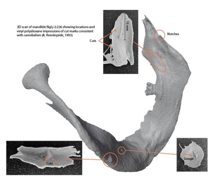 3D scan of mandible