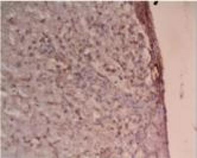 Immunohistochemical Staining