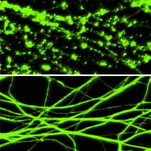 Preventing Axon Degeneration
