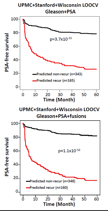 New machine learning model improves prediction of prostate cancer recurrence