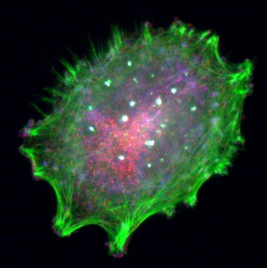 Invading Melanoma Cell