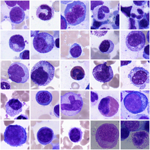 Bone marrow cells