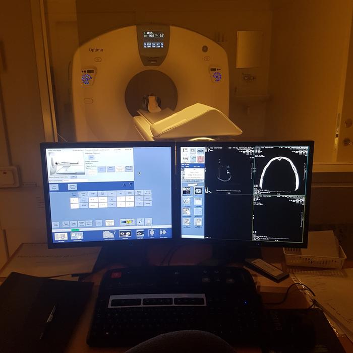 CT Scan and image analysis of Viking skull