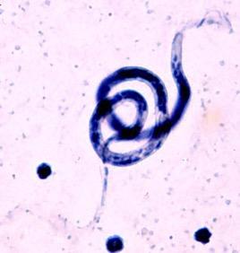Researchers Profile Symbiotic Relationship between Bacteria and Filarial Nematodes