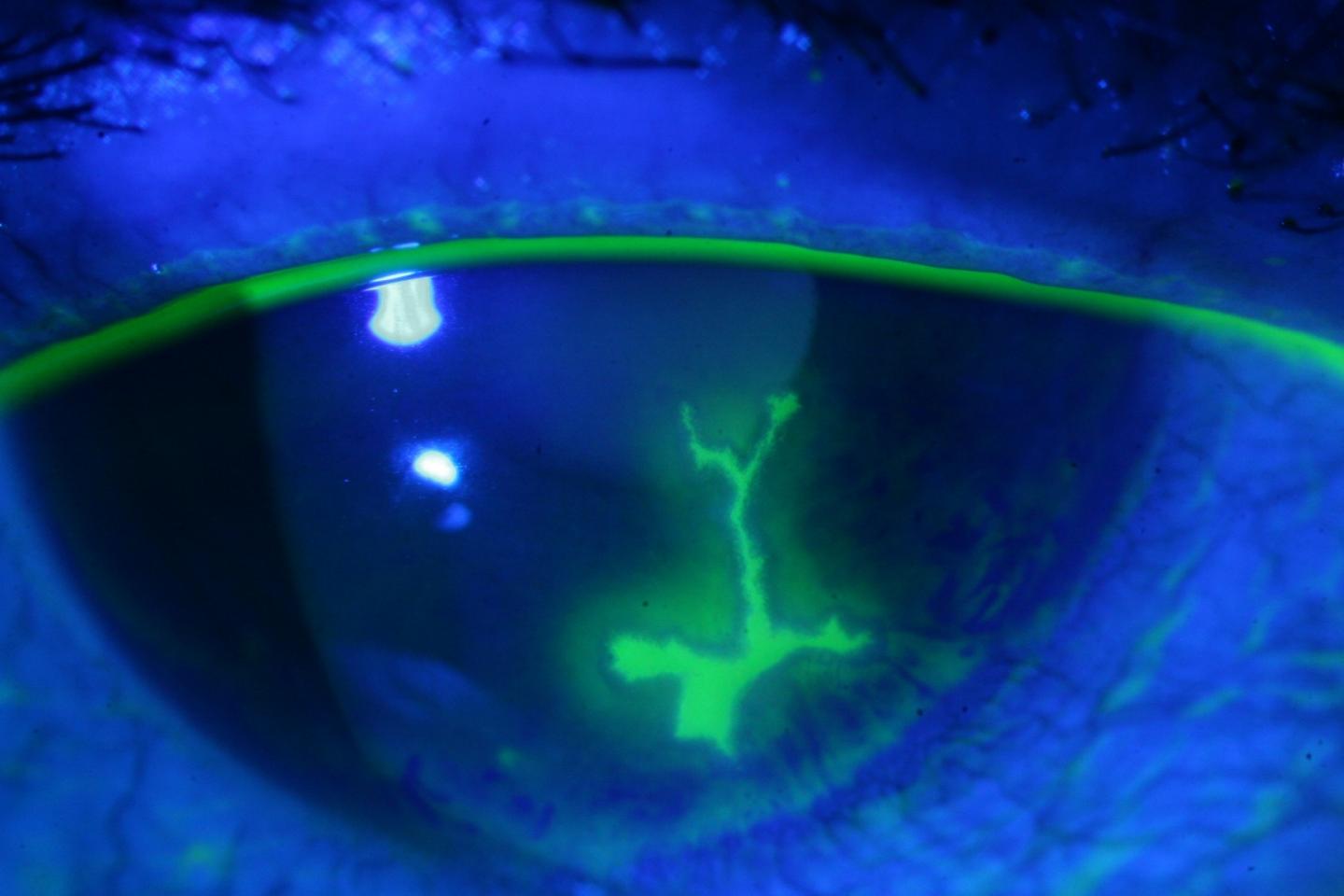 Towards a Cure for Herpesviruses