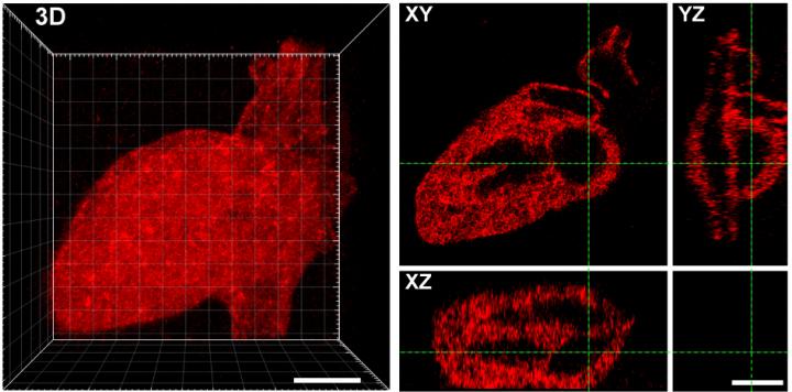Hydrogel patterning with mCherry -- 3D human heart
