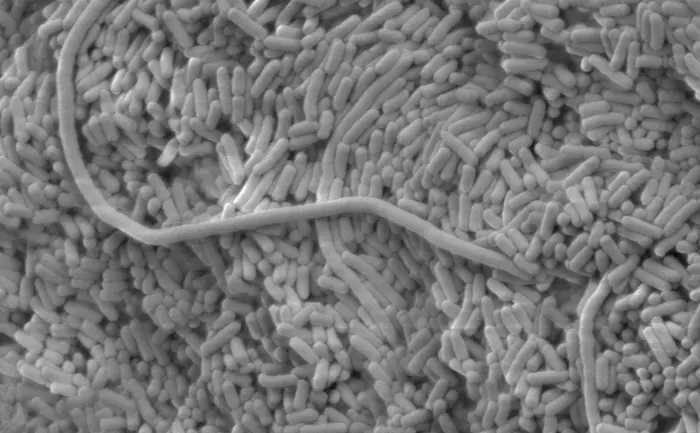 Microscope image of bacteria.