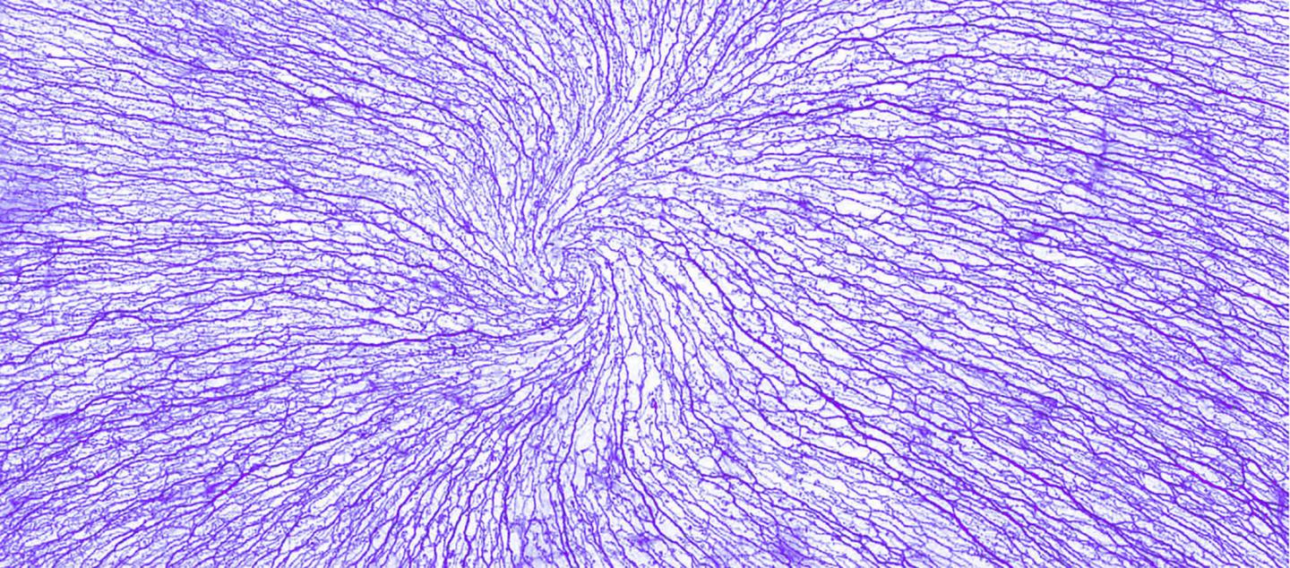 Sensory Nerves in the Cornea