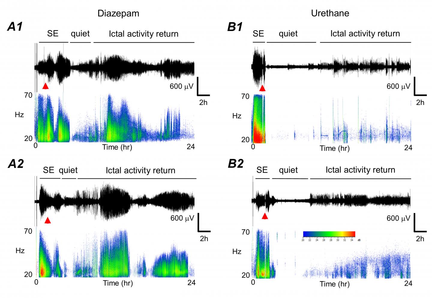 Suppressing Seizures
