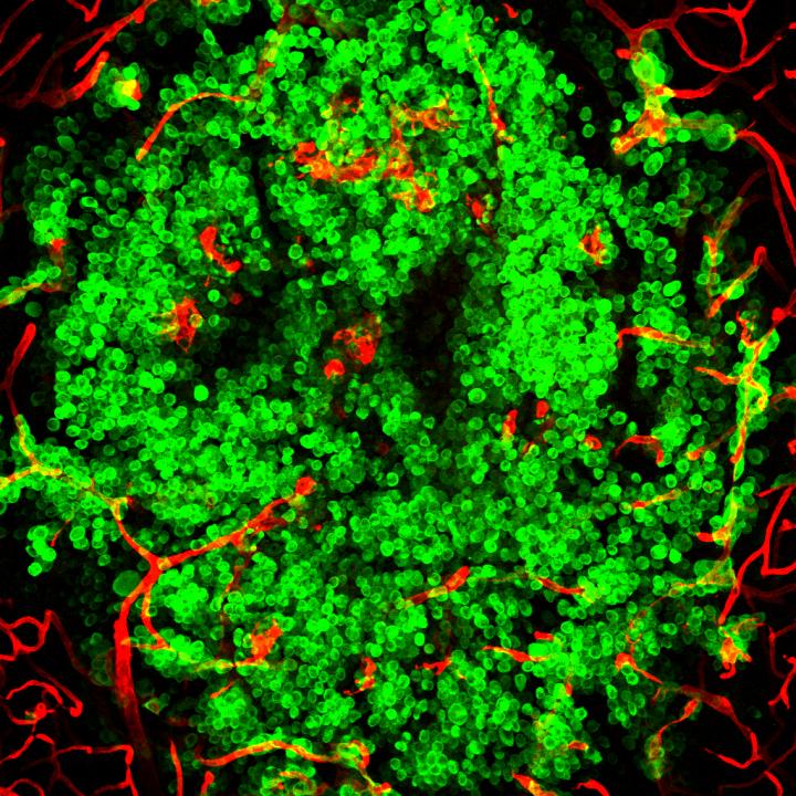 Brain Metastasis, CNIO [IMAGE] EurekAlert! Science News Releases