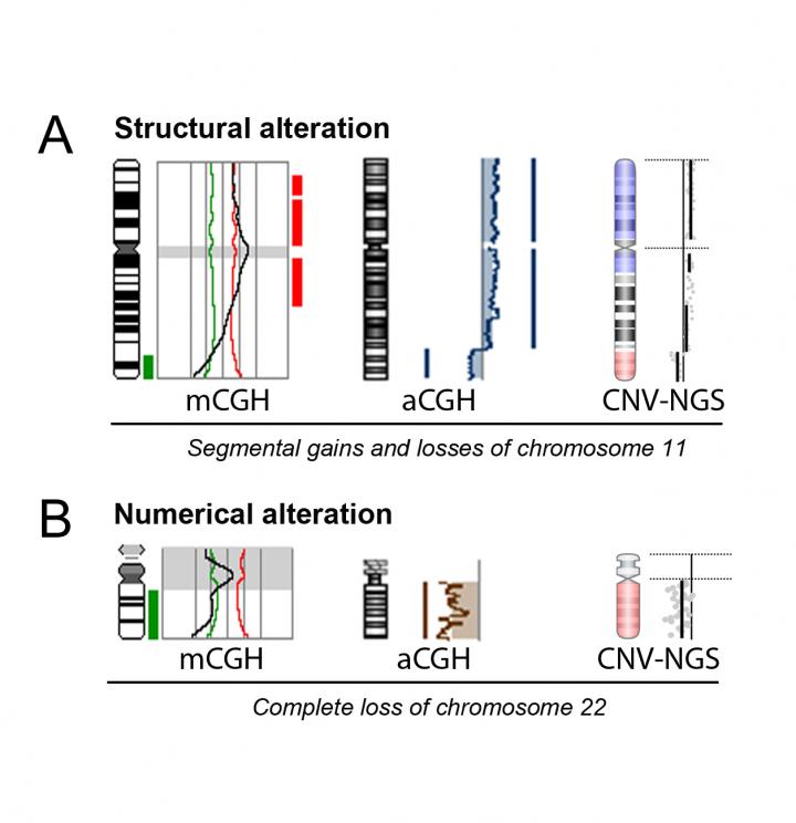 Double Factor Preimplantation Genetic Testing Now Possible Through Massive Sequencing Techniques
