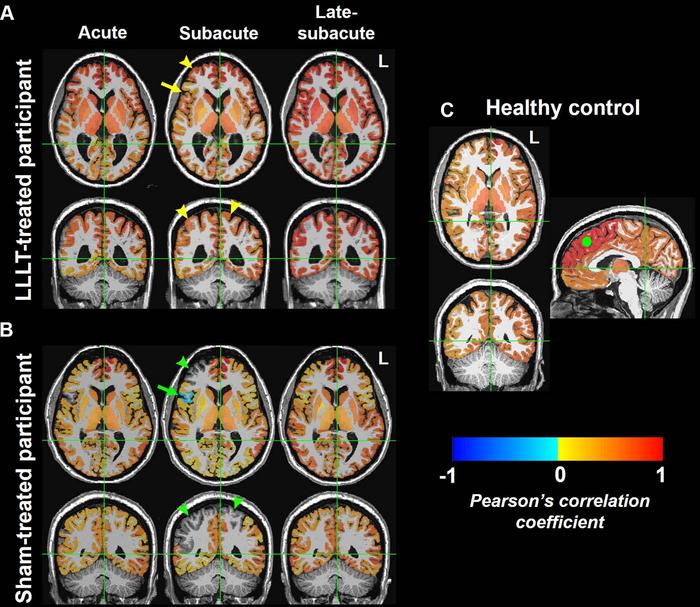 Functional MRI brain maps of resting-state functional connectivity