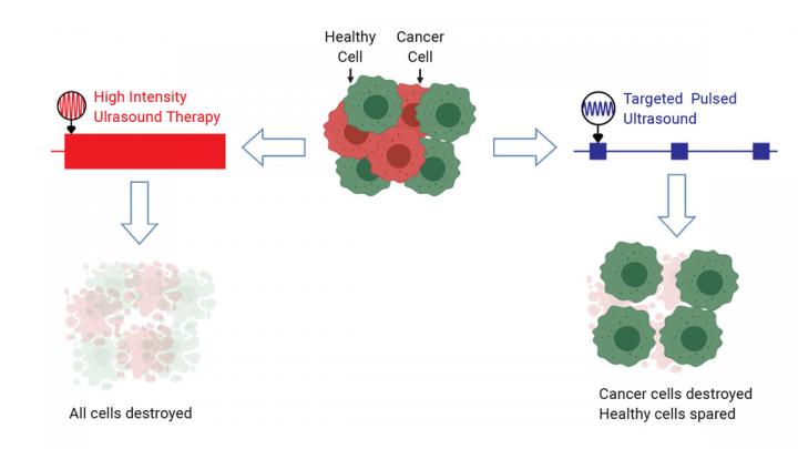 Targeted Pulsed Ultrasound Takes Advantage of the Unique Mechanical Properties of Cancer Cells