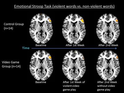 Functional Magnetic Resonance Images