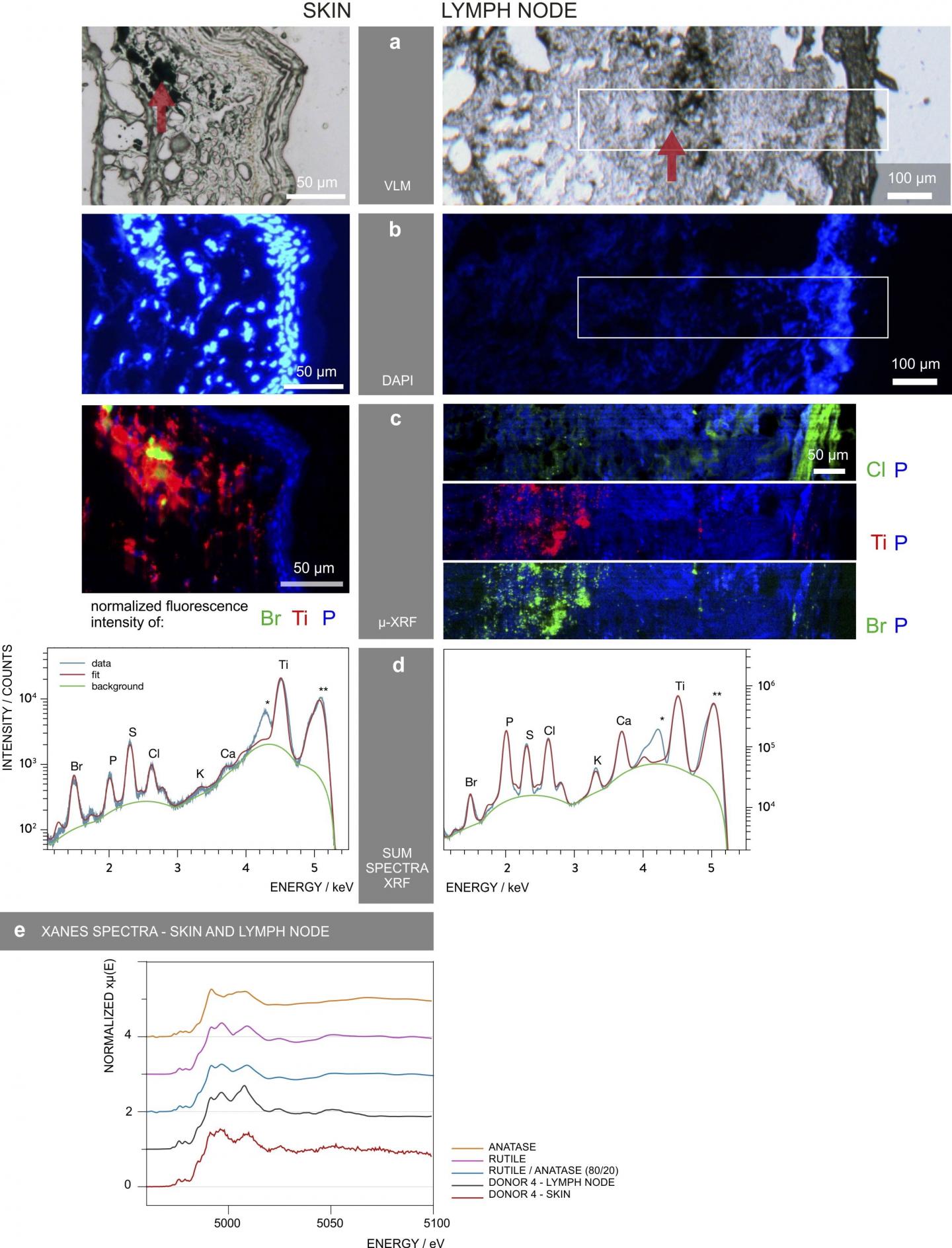 X-Ray Fluorescence Measurements Identifies and Locates Tattoo Particle Elements in Skin And Lymph No