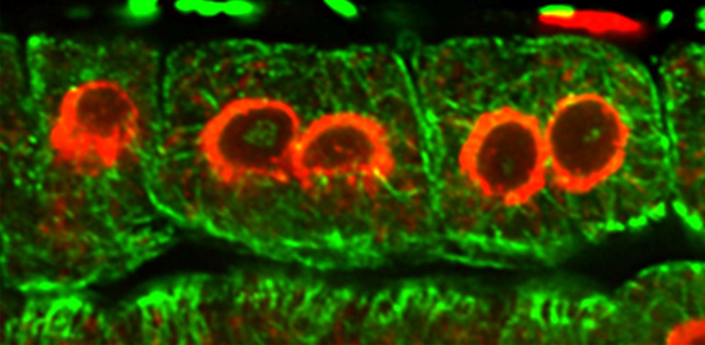 Plant Cells with More than One Nucleus