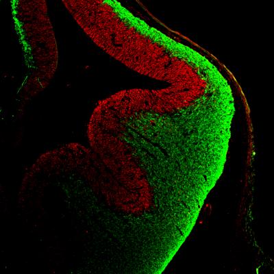 Embryonic Mouse Cortex with Neural Stem Cells and Neurons