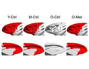 Metformin slows brain aging in primates