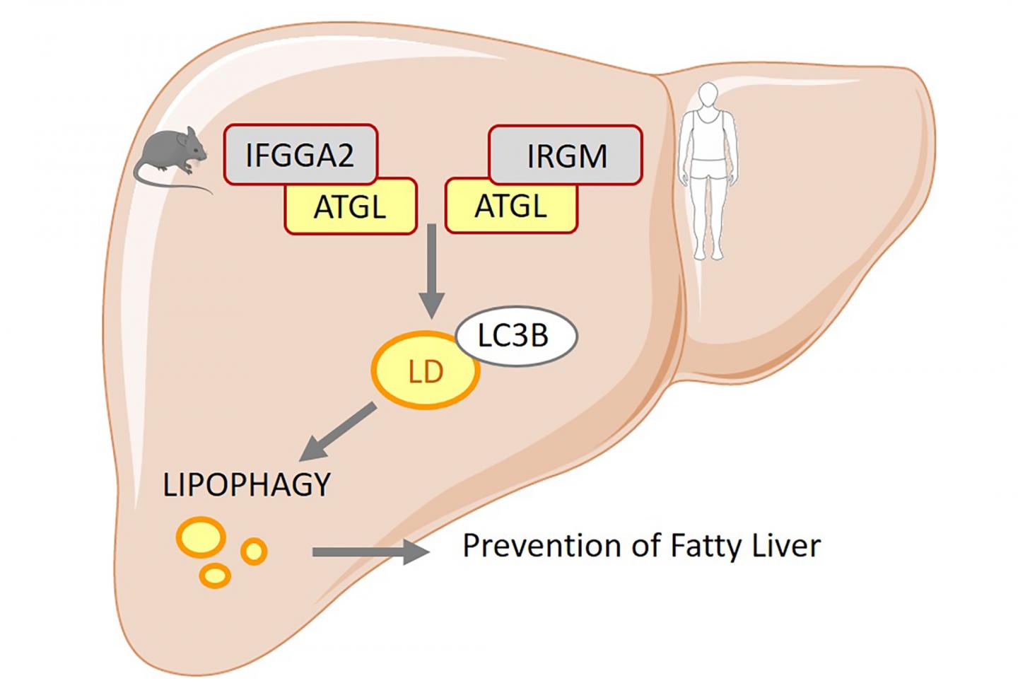 Additional Genetic Cause for Non-alcoholic Fatty Liver Disease Discovered