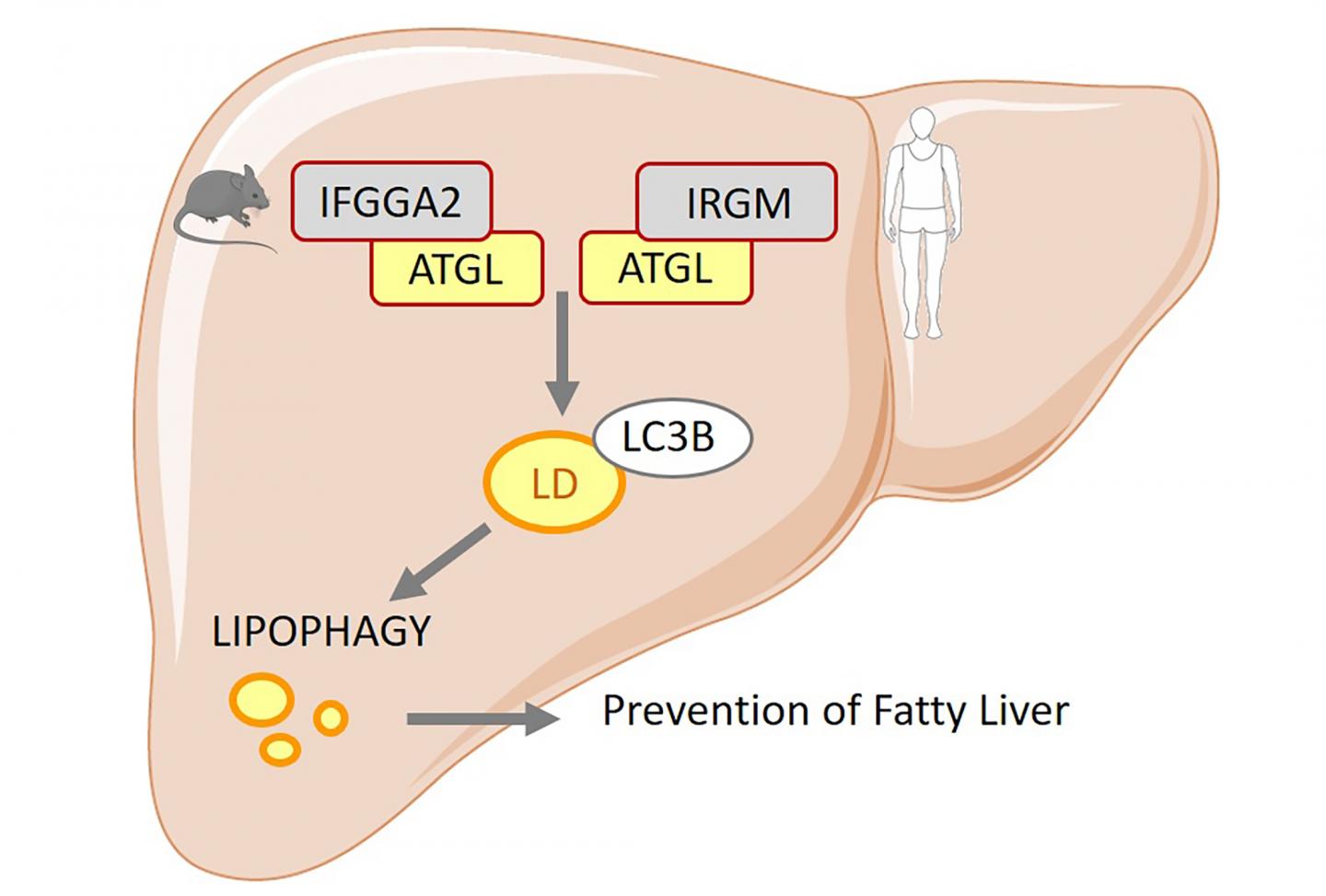 Non alcoholic fatty liver