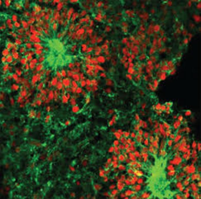 Brain cells remain healthy after a month on the International Space Station, but mature faster than brain cells on Earth