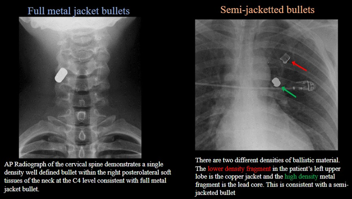Full Metal Jacket Bullets (left) vs. Semi-Jacketed Bullets (right)