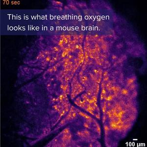 New Imaging Method Illuminates Oxygen's Journey in the Brain