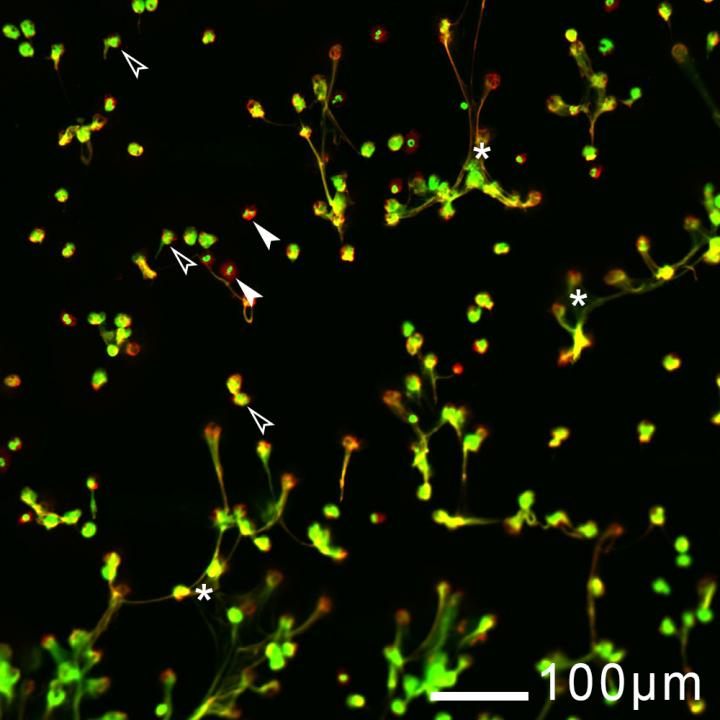 Neutrophils Cast Nests to Protect us From Harm