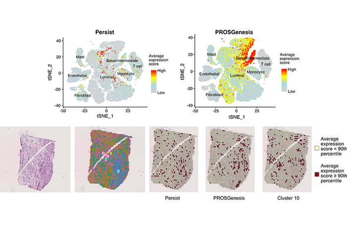 Single-cell level regenerative (PROSGenesis) and stem-like (Persist) gene patterns identified in prostate specimens