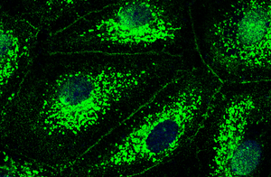 Cells in the lung's blood vessels with CFTR channel