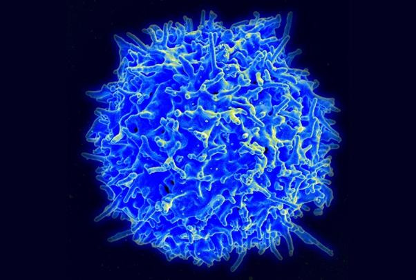 Scanning electron micrograph of a human T lymphocyte (T cell) from a healthy donor's immune system.