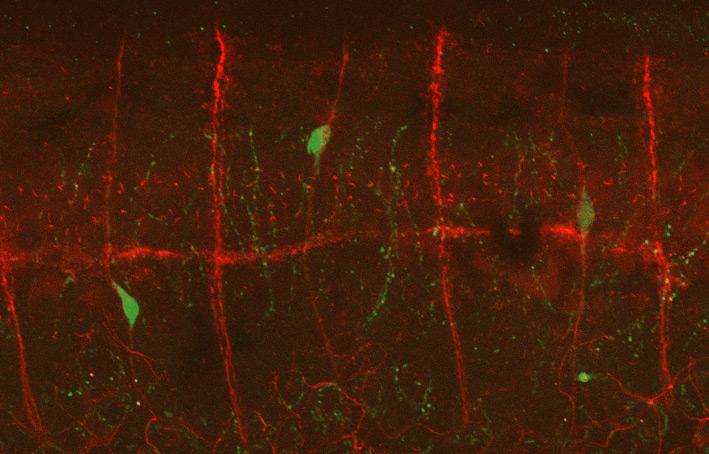 Stem Cells Migrate to the Gut