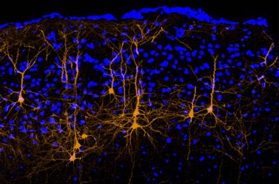 Brain Wiring Quiets the Voice Inside Your Head