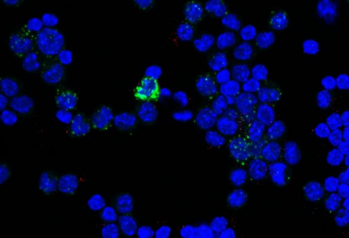 M2 Macrophages