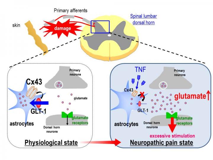 難治性疼痛の発症メカニズムを解明 | EurekAlert!