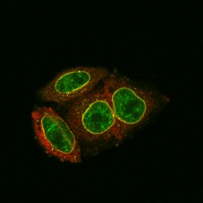 How HIV DNA is Blocked from Entering the Cell Nucleus