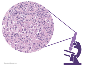 Evaluation of H&E slides