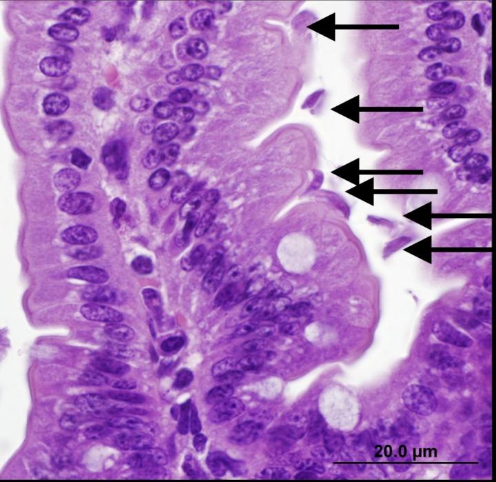 Co-Infection with Two Common Gut Pathogens Worsens Malnutrition in Mice