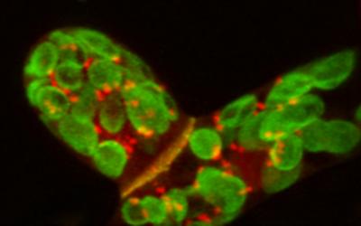Fluorescence Microscope Image 