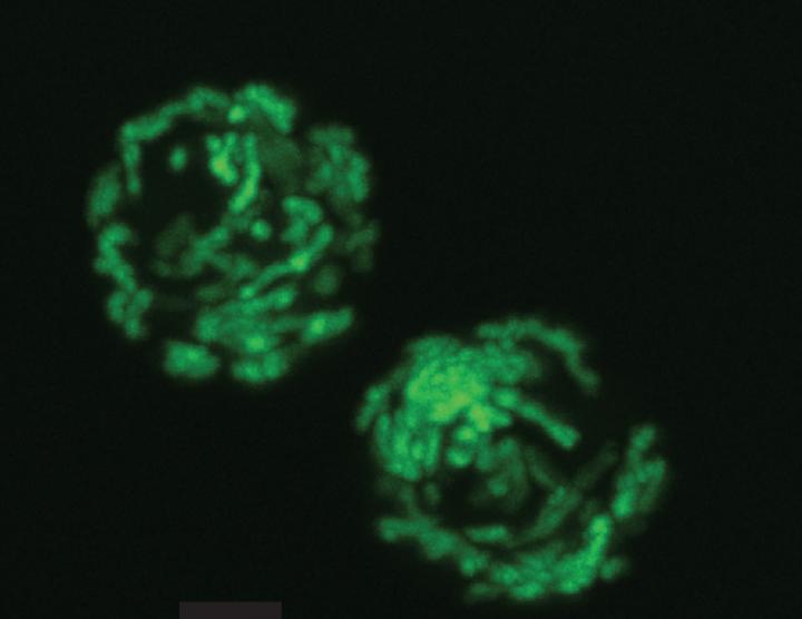 Mitochondria in Hematopoetic Stem Cells