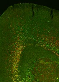 New Kinds of Brain Cells Revealed by Salk and UCSD Scientists