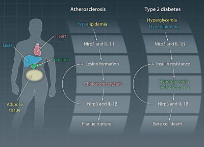 The Inflammasome in Diabetes and Atherosclerosis (2 of 2)