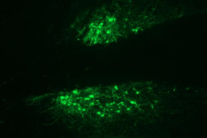 Magnified Image of Cells in Extended Amygdala